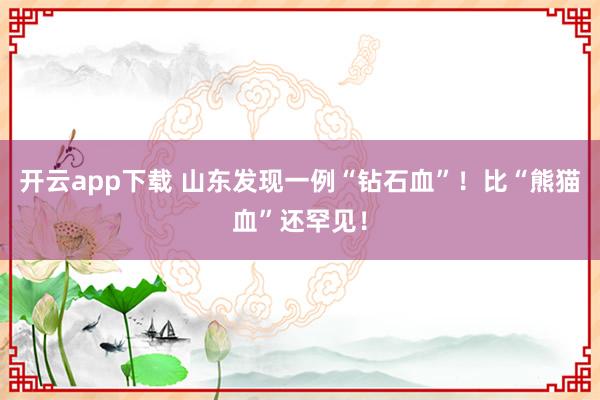 开云app下载 山东发现一例“钻石血”!比“熊猫血”还罕见!