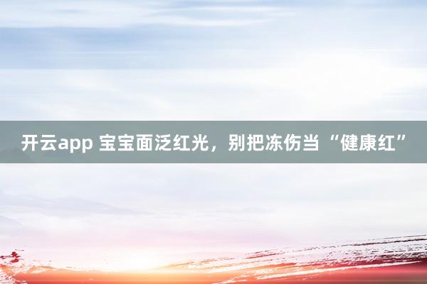 开云app 宝宝面泛红光，别把冻伤当 “健康红”